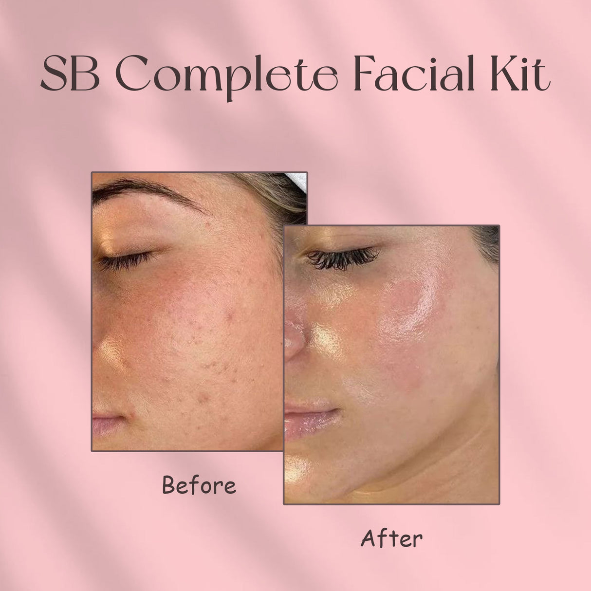 Simply Beautiful SB Complete Facial Kit (60ML)