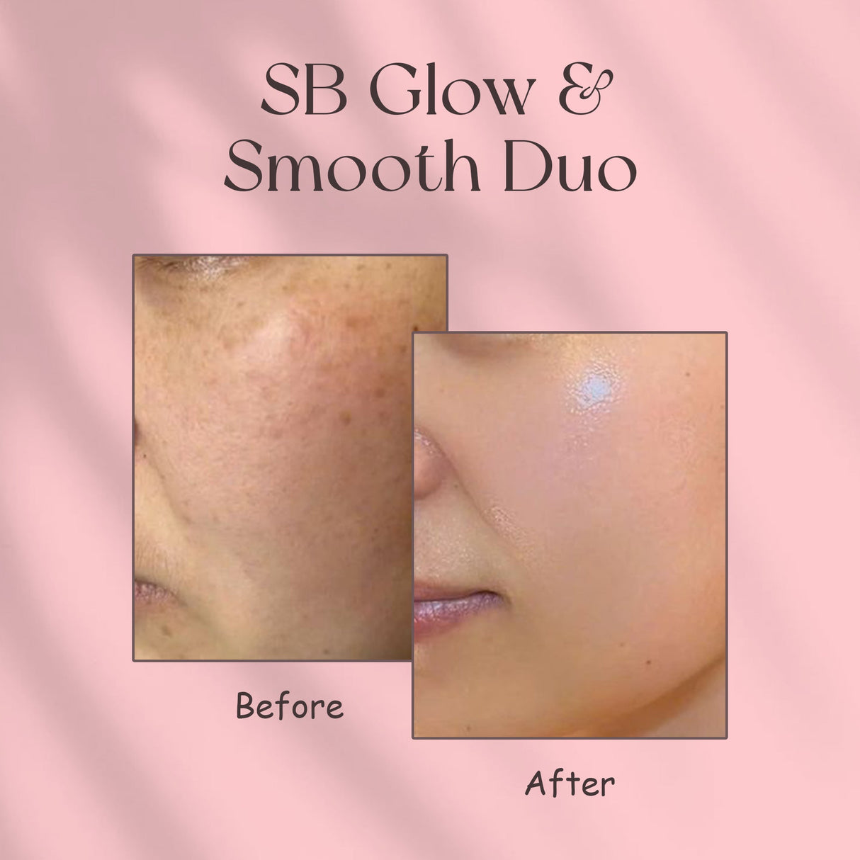 Simply Beautiful SB Glow & Smooth Duo