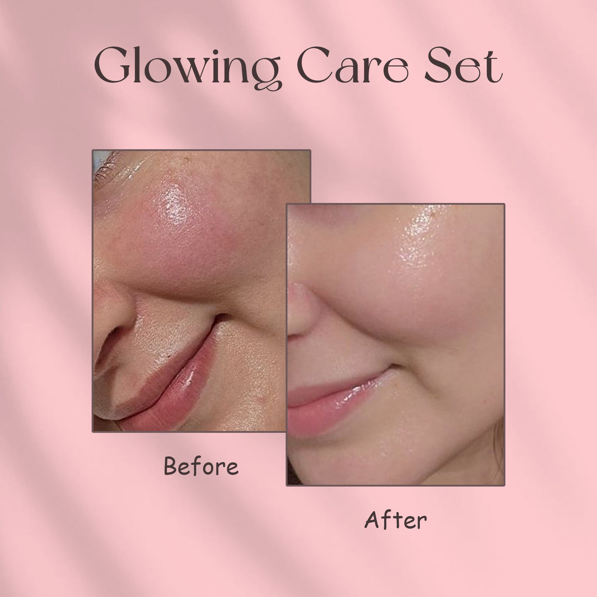 Simply Beautiful Glowing Care Set