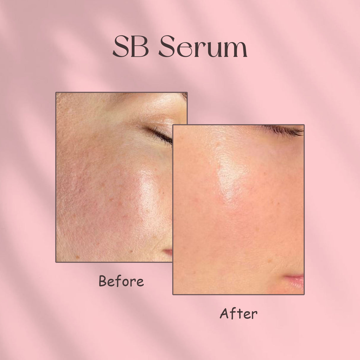 Simply Beautiful SB Serum