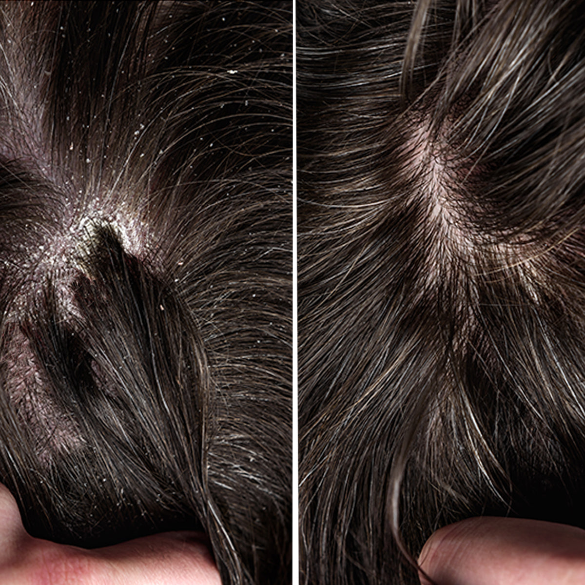 Conatural-Anti-Dandruff Shampoo for Men