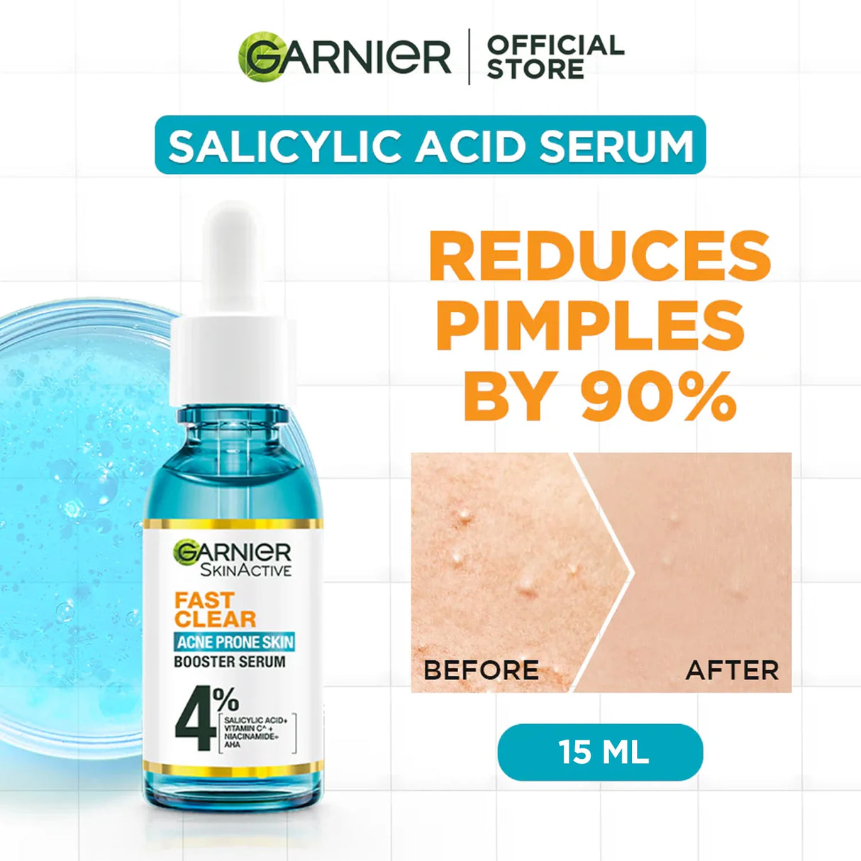 Garnier - Fast Clear Serum For Acne Prone Skin - 15ml
