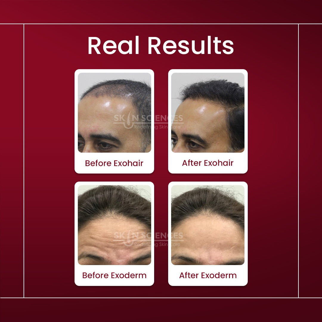 Skin Sciences Exosome Skin & Hair Bundle