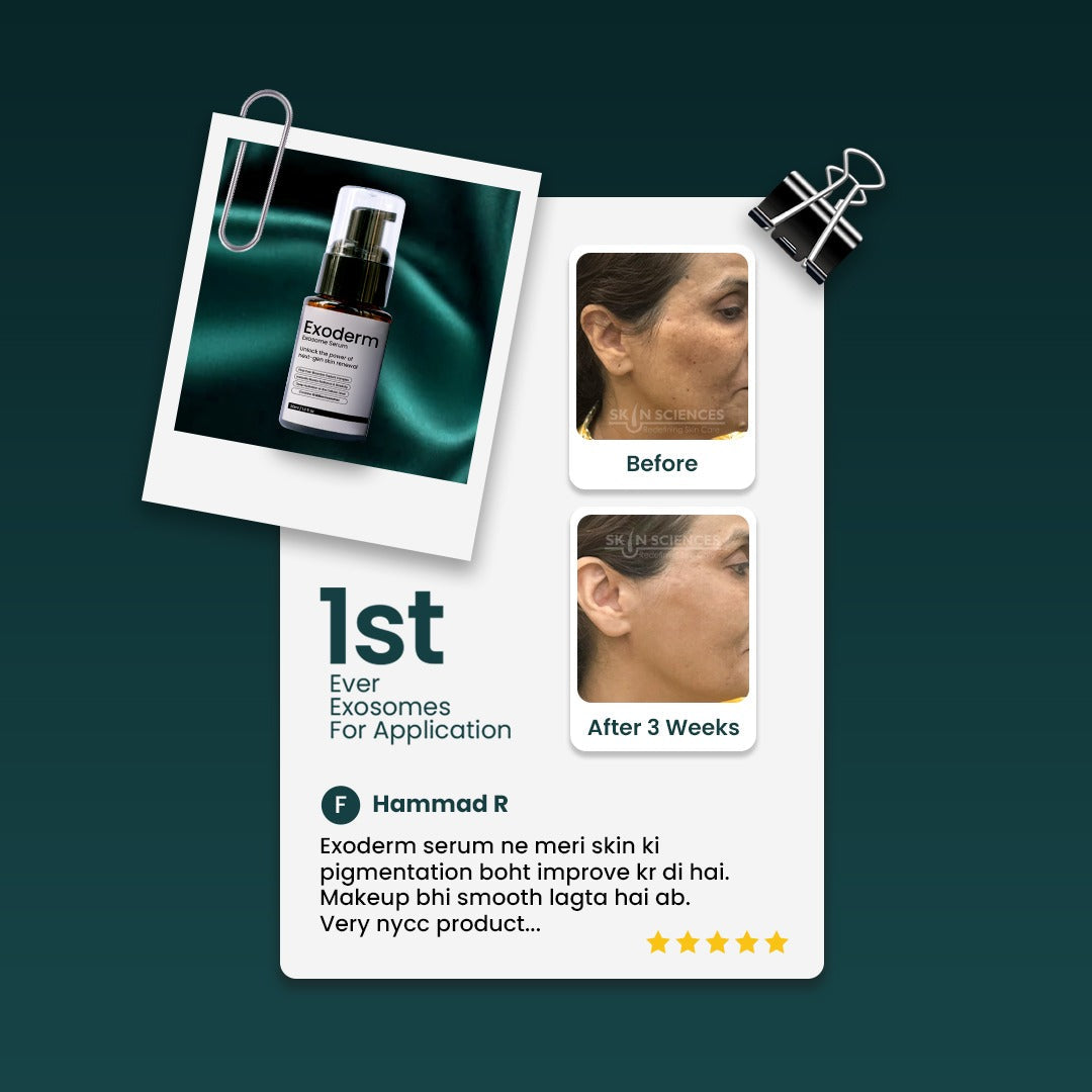 Skin Sciences Exoderm Serum