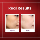 Skin Sciences Alpha Arbutin Serum