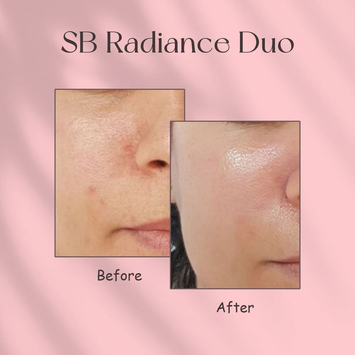 Simply Beautiful SB Radiance Duo