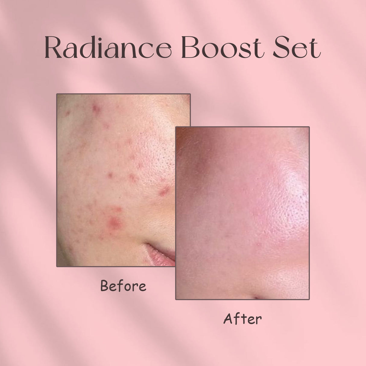 Simply Beautiful Radiance Boost Set