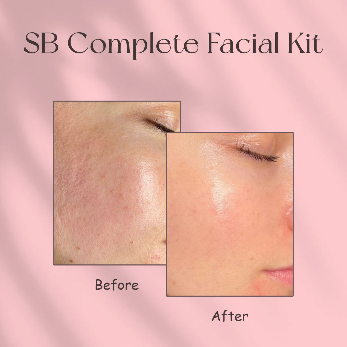 Simply Beautiful SB Complete Facial Kit (200ML)