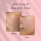 Simply Beautiful SB Glow & Smooth Duo