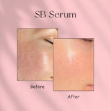 Simply Beautiful SB Serum