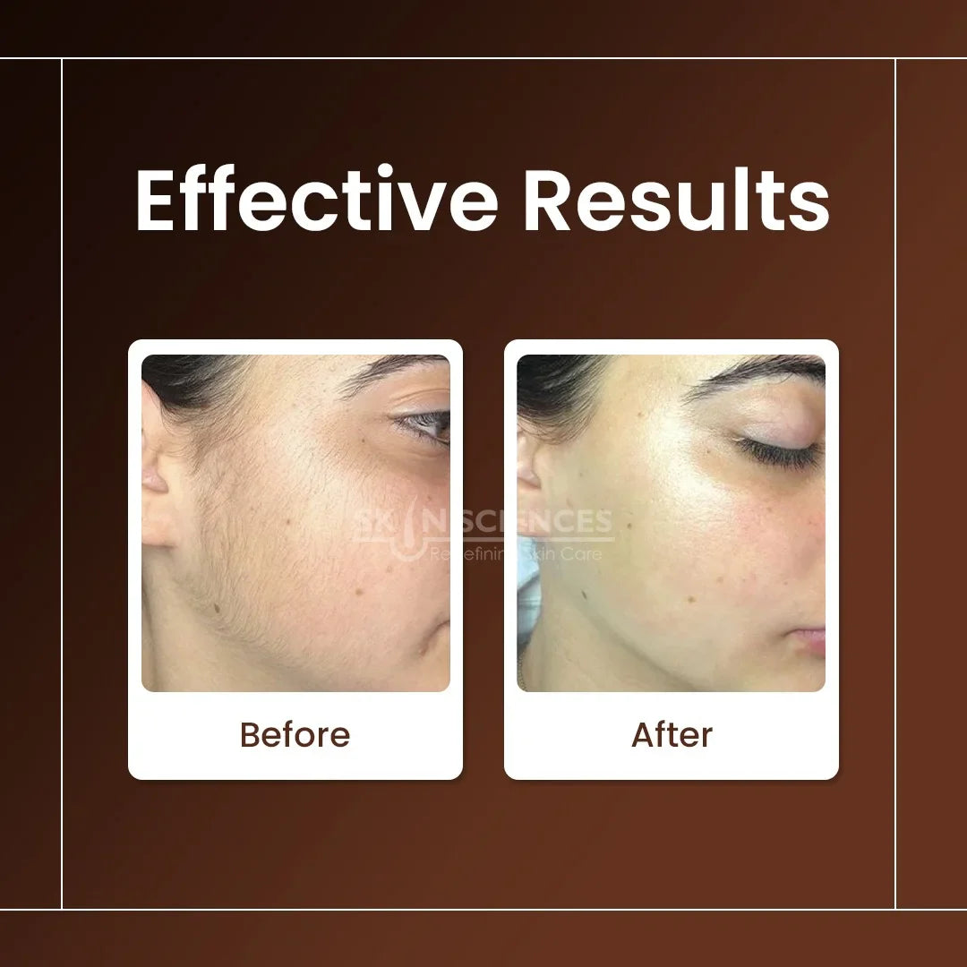 Skin Sciences Never Grow Hair Serum