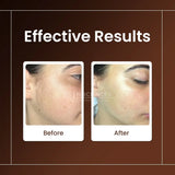 Skin Sciences Never Grow Hair Serum