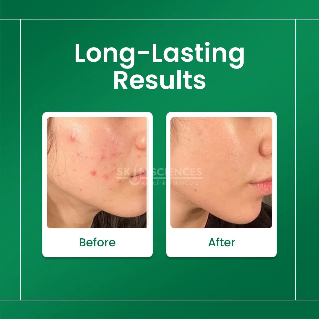 Skin Sciences Niacinamide Serum