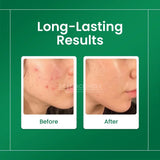Skin Sciences Niacinamide Serum