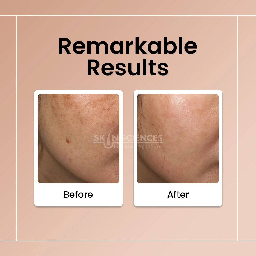 Skin Sciences Radiance Day Cream