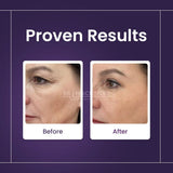 Skin Sciences Retinol Serum