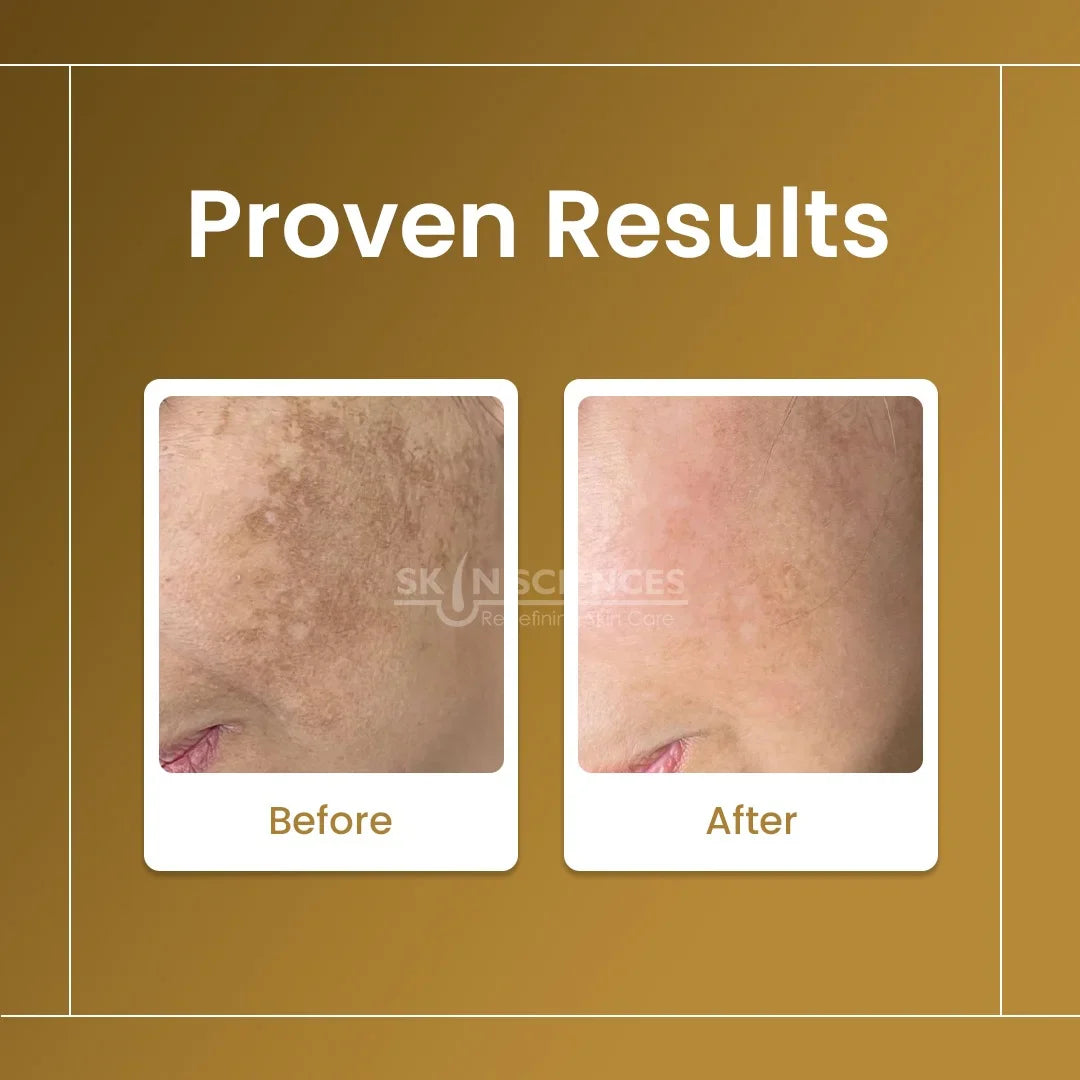 Skin Sciences Sunblock SC Sebum Control