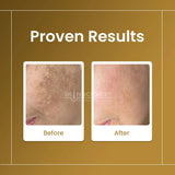 Skin Sciences Sunblock SC Sebum Control