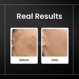 Skin Sciences TxA Serum