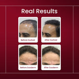 Skin Sciences Exosome Skin & Hair Bundle